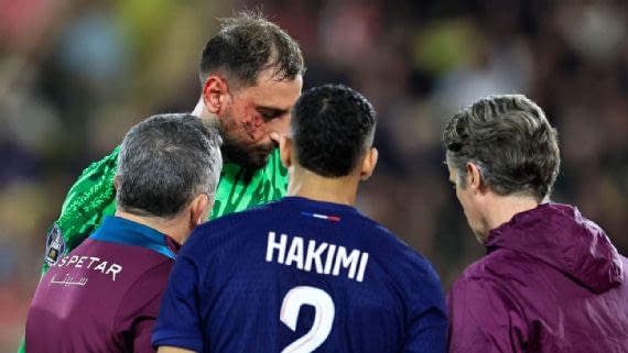 PSG keeper Donnarumma injured by cleat to face