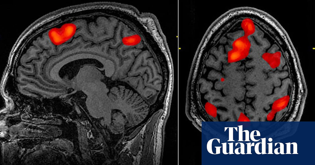 AI Makes Non Invasive Mind Reading Possible By Turning Thoughts Into Text - Credit: The Guardian