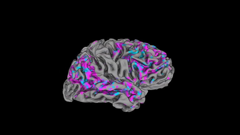 A Decoder That Uses Brain Scans To Know What You Mean - Credit: NPR