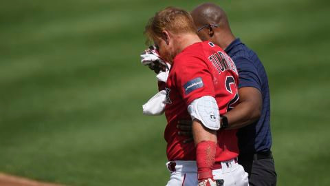 Turner is helped off the field after being hit in the face by a pitch.