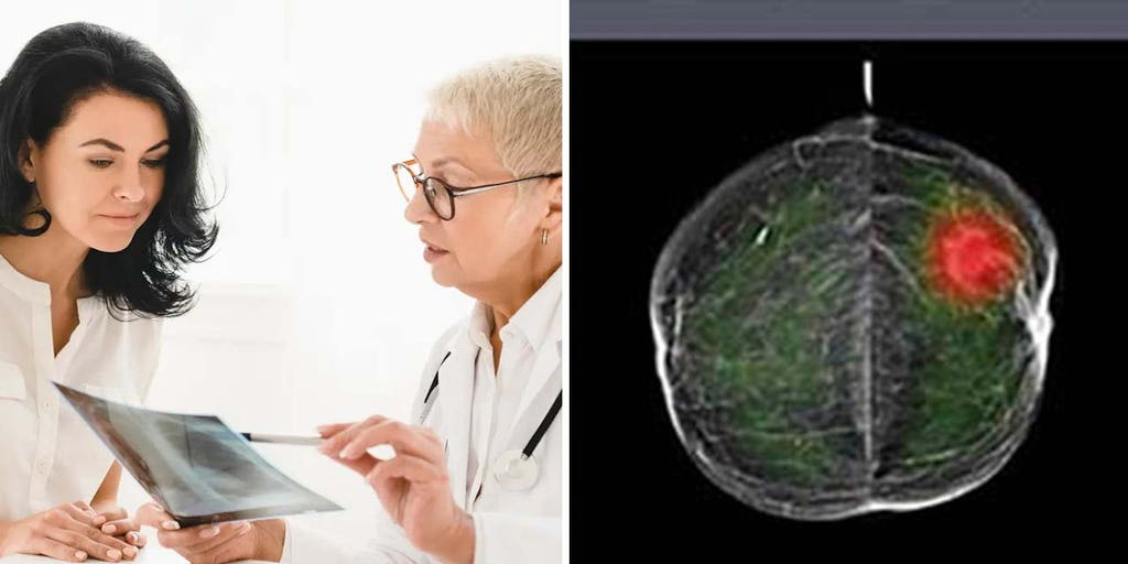 AI technology used to read mammograms could put patients at potential risk: study - Credit: Fox News